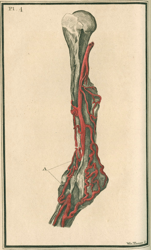 Detail of Dissection of an arm on which the operation for the Aneurism had been performed by unknown
