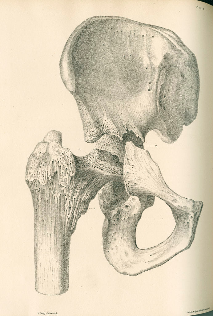 Detail of Front view of the right hip and femur by J Perry
