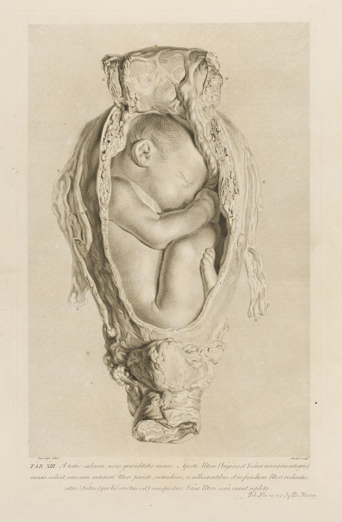 Detail of Foetus in the womb by Christian von Mechel