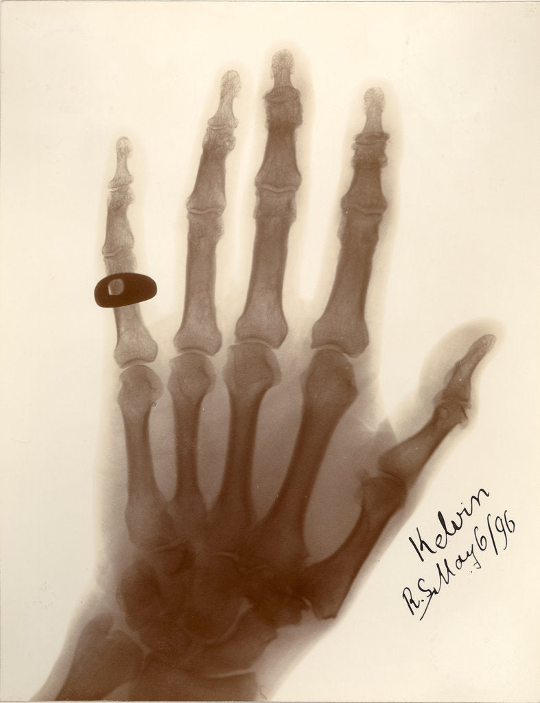 Detail of X-ray photograph of the hand of William Thomson by Alan Archibald Campbell Swinton