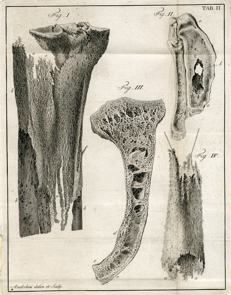 Detail of Sections of the Tibia by Faustino Anderloni