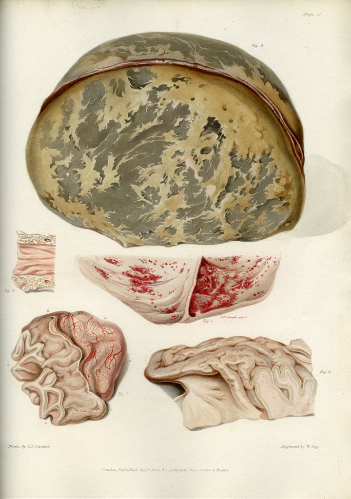 Detail of Parts of the brain including the dura mater by William Say