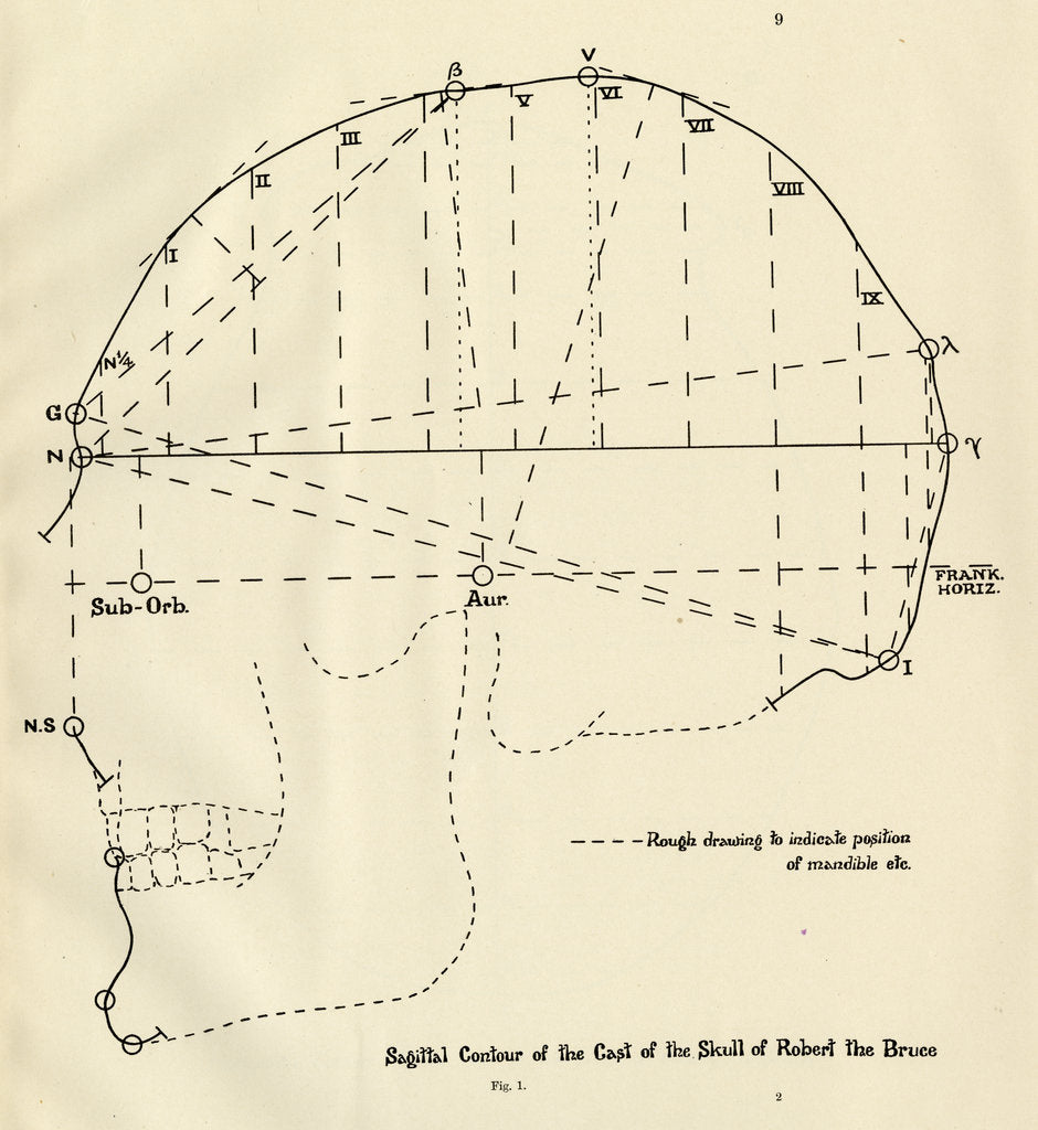 Detail of Measurements of Robert the Bruce's skull by unknown