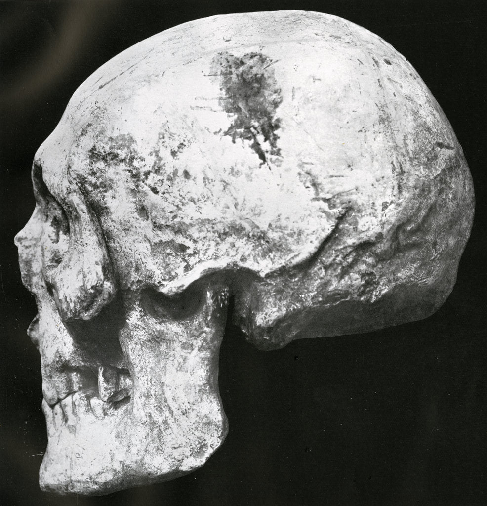 Detail of Robert the Bruce's skull by unknown