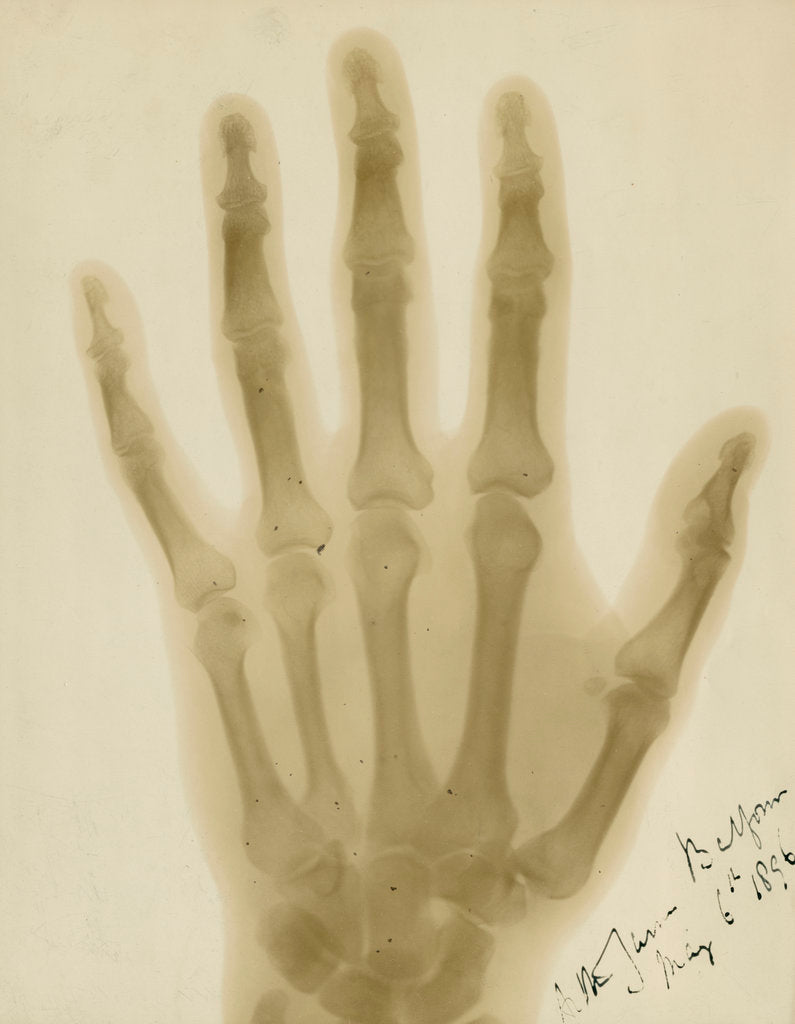Detail of X-ray photograph of the hand of Arthur James Balfour by Alan Archibald Campbell Swinton