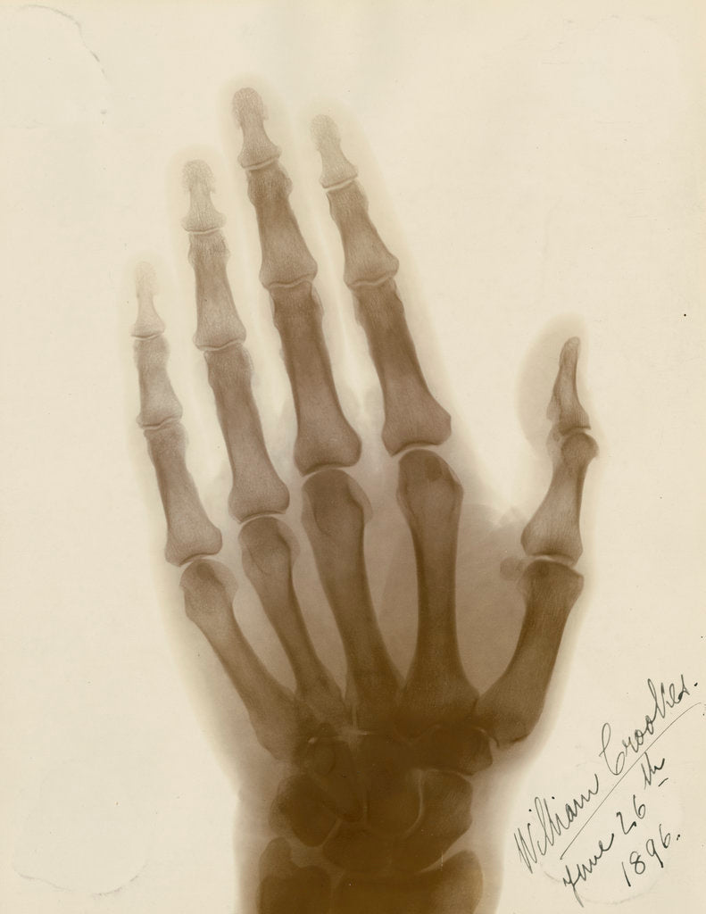 X-ray photograph of the hand of William Crookes by Alan Archibald Campbell Swinton